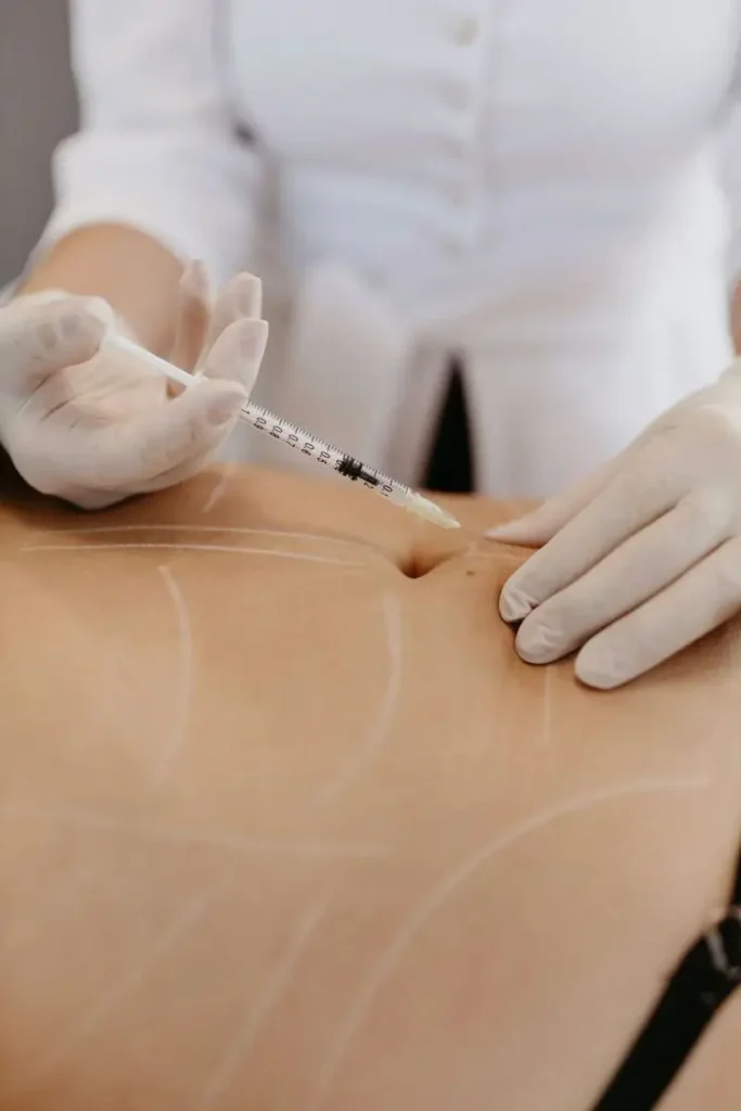 Fat Dissolving Injections