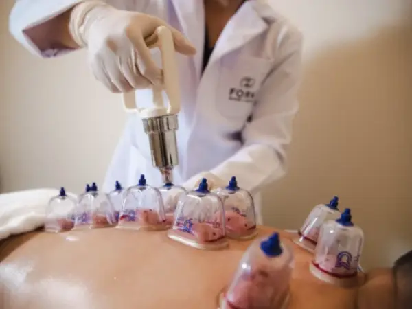 Hijama Therapy Al Jadaf Dubai