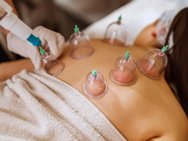 Hijama Therapy Al Jadaf Dubai