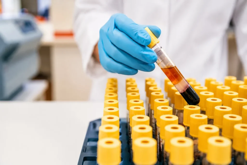 Basic Lab Tests in Dubai – Accurate Diagnostics for Better Health